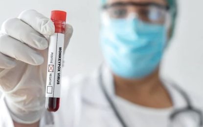 Instituto Adolfo Lutz confirma 1° caso de varíola dos macacos no país