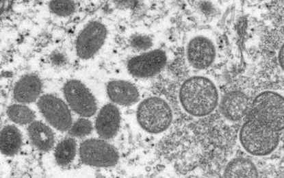 Varíola dos macacos: Saúde notifica 6 casos suspeitos e descarta 2